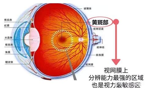 眼睛有斑|黄斑病变